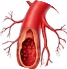 Doppler Arterial