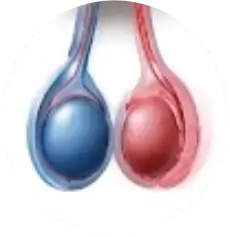 Doppler Testicular